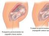 A placenta previa az elülső fal mentén patológia vagy enyhe eltérés a normától?